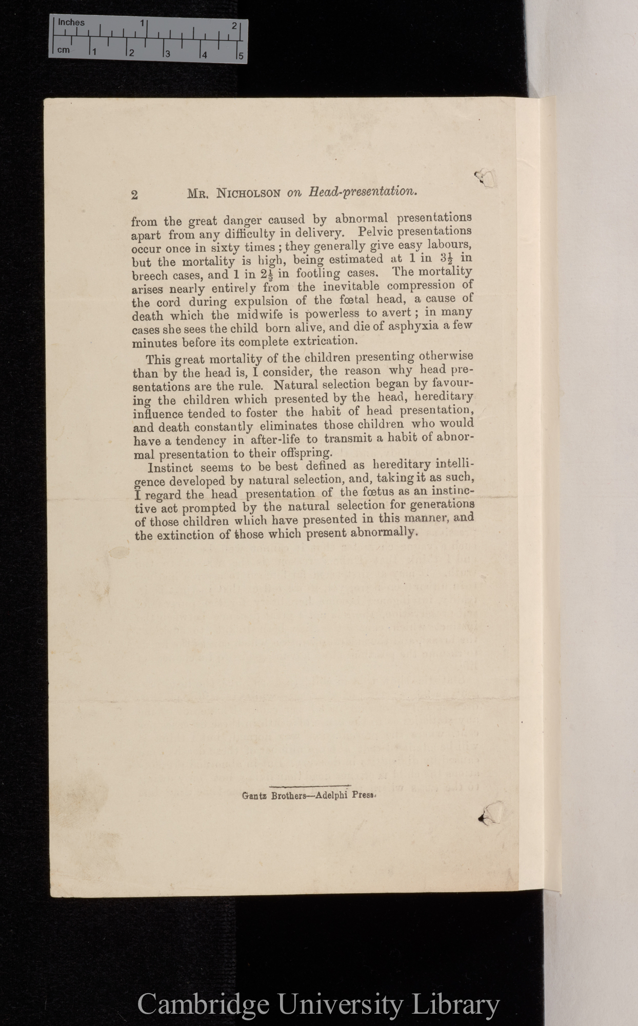 Nicholson, Edward. On the cause of head presentation in the foetus &#39;Madras Monthly Journal of Medical Science&#39;: [2]