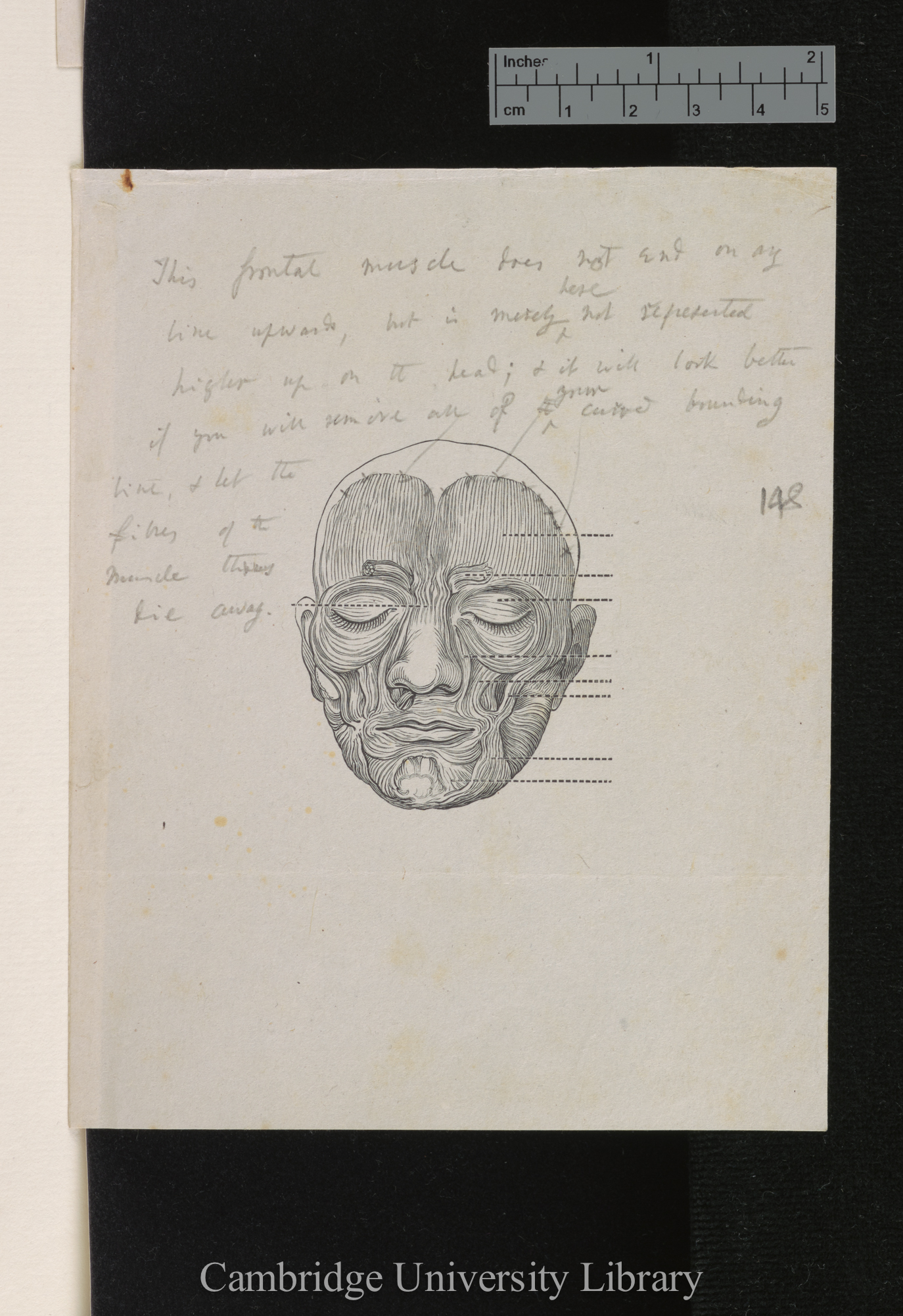 (printed maps of facial muscles, annotated)