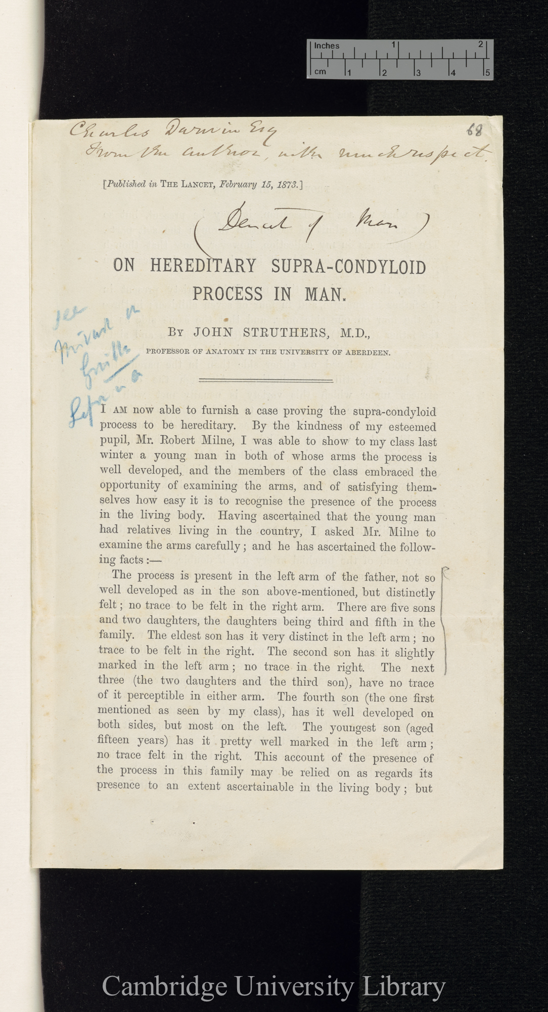 Struthers, John. On hereditary supra-condyloid process in man &#39;[source unknown]&#39;: 1 sheet folded, reset from &#39;Lancet&#39; February 1873: 231-232 [1]