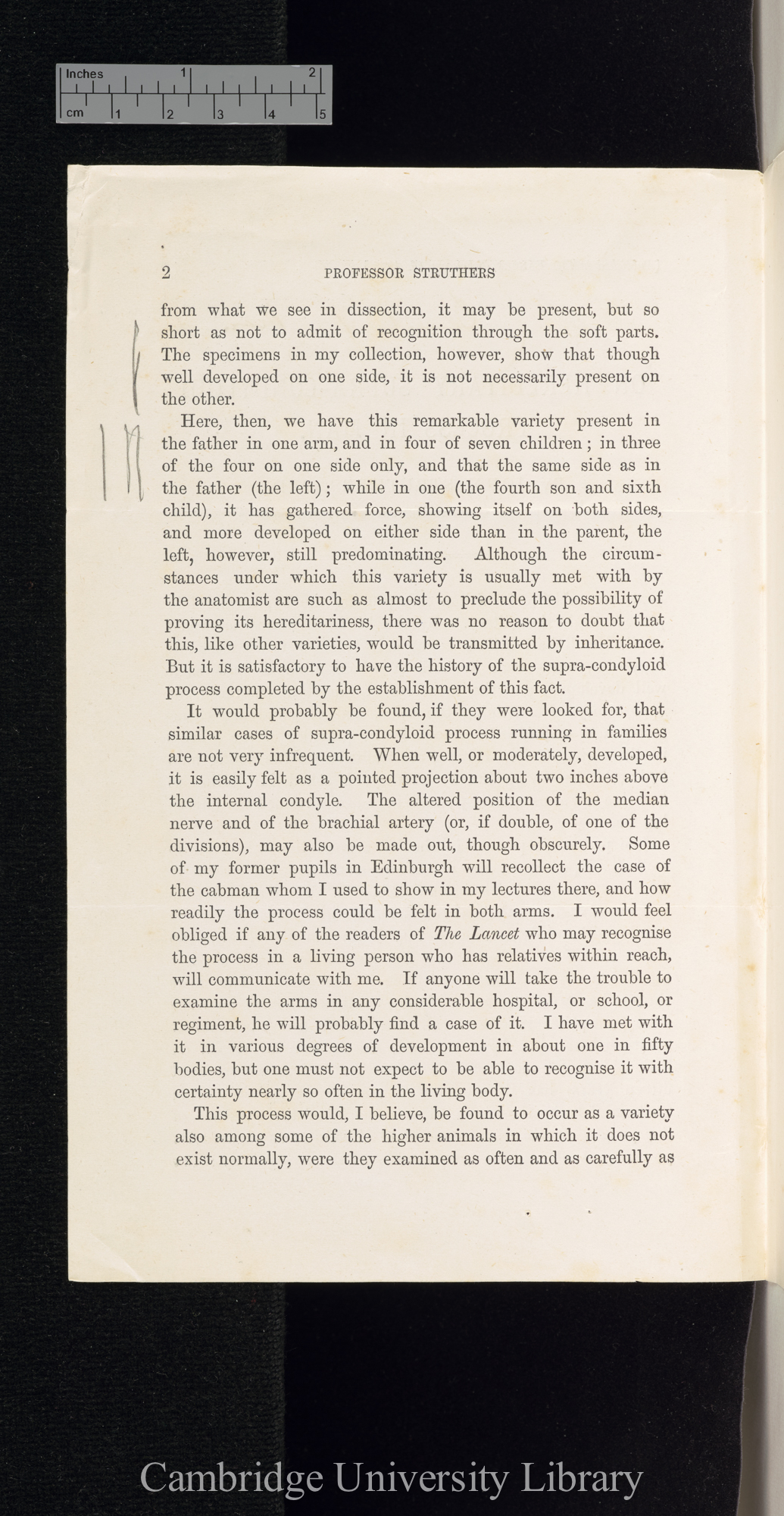 Struthers, John. On hereditary supra-condyloid process in man &#39;[source unknown]&#39;: 1 sheet folded, reset from &#39;Lancet&#39; February 1873: 231-232 [2]