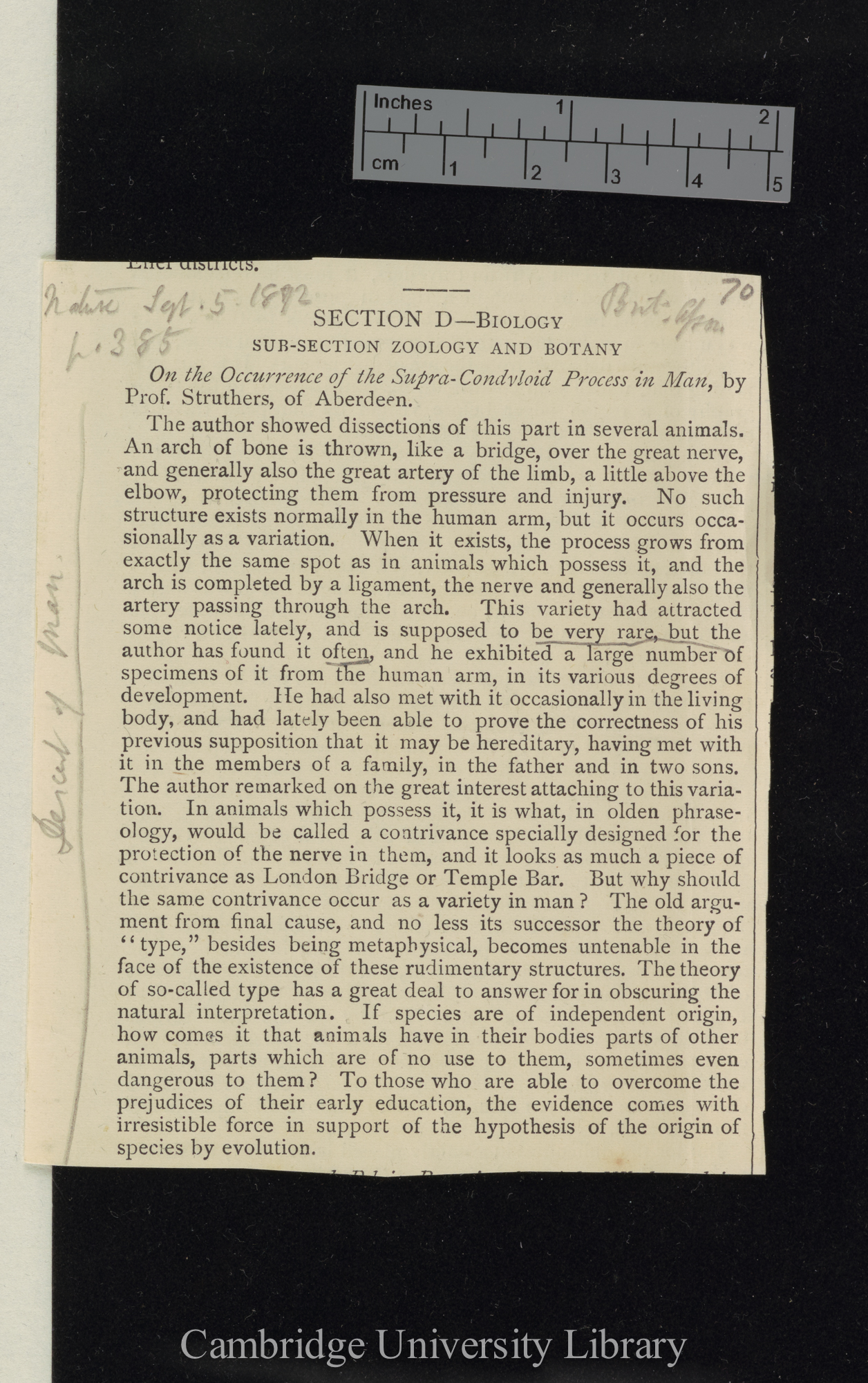 Struthers, John. On the occurrence of the supra-condyloid in man &#39;Nature&#39; 6: 385